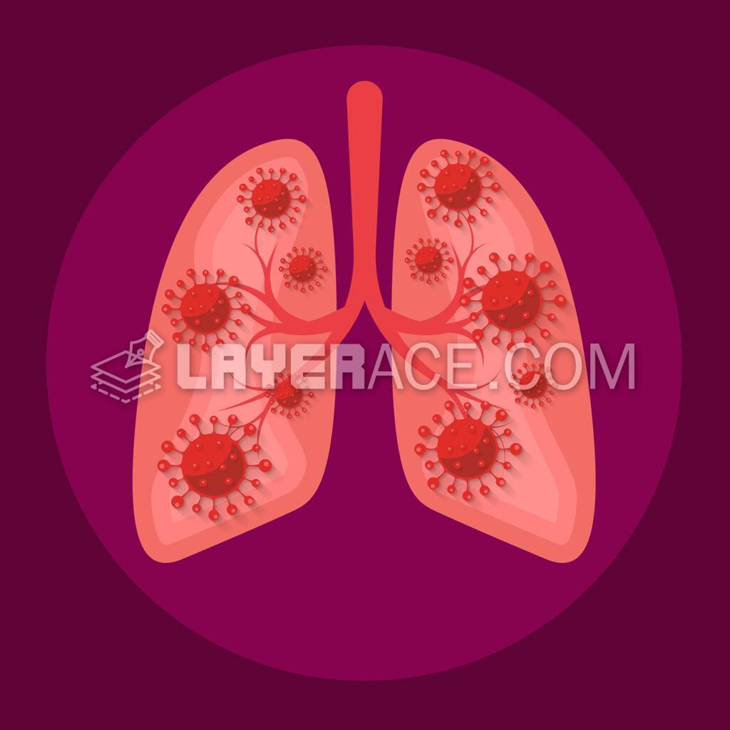 Coronaviruses In The Lungs